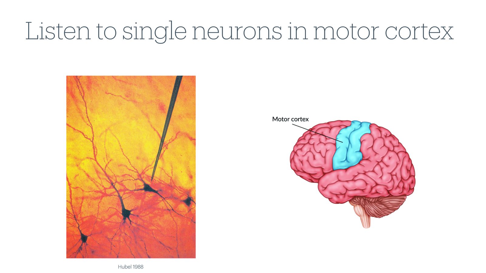 从头皮到单个神经元:将电极植入运动皮层(motor cortex)以获取高质量信号
